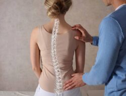 Apakah Chiropractic Bisa Menyembuhkan Skoliosis? Cek Faktanya